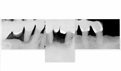 Xray