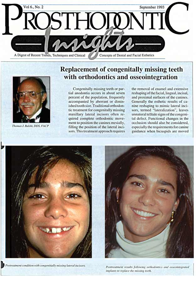 Insights Newsletter Nov 1994