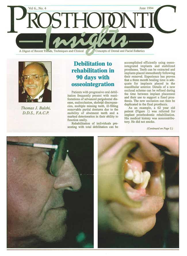 Debilitation to Rehabilitation in 90 Days