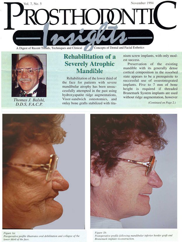 Insights Newsletter Nov 1994