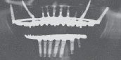 X-ray