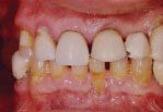 Preop Photo