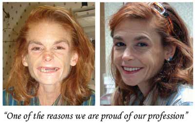 Before and After Photos