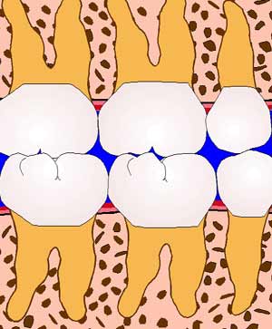 Bone picture
