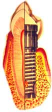 Implant and bone