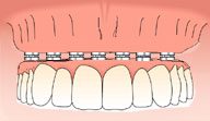 Oral Rehabilitation
