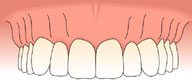 Oral Rehabilitation