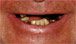Teeth In An Hour Planning Image