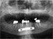 Postop Ceph Xray