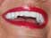 Zirconium All-Ceramic Crowns