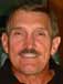 Full upper and lower Teeth In A Day