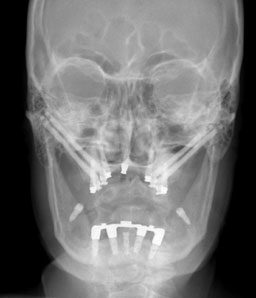 Case of the Month