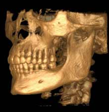 3D image