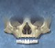 Zygomatic Dental Implant