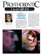 Insights Newsletter - Dental Implant Osseointegration Treatment - 1994_06-04_6-1
