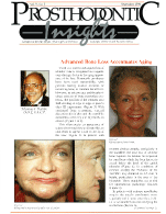 Insights Newsletter - Dental Implant Treatment for a Patient With Advanced Bone Loss -1996_06_9_2-1