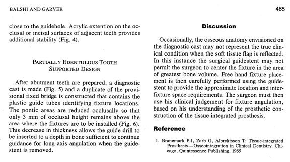 Surgical Guidestent Article