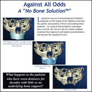 No Bone Solution for Successful Dental Implant Treatment