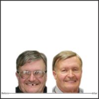 Insights Newsletter Highlights Dental Treatment and Planning