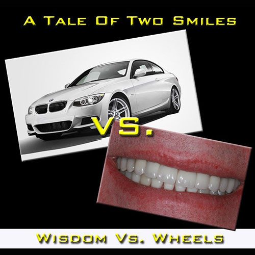 A Tale Of Two Smiles: Or Wisdom Vs. Wheels