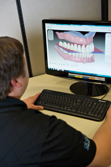 Designing AvaDent™ Digital Denture