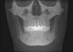 CT Scanning Technology - scan of frontal view