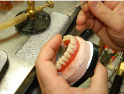 Dental Implant Technology