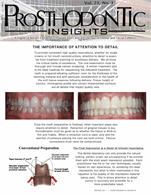 Insights Newsletter - The Importance Of Attention To Detail - 2011_02_15-1