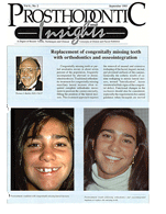 Insights Newsletter - Replacement of Congenitally Missing Teeth With Dental Implants- 1993_09_06_2-1