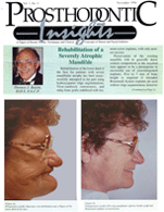 Insights Newsletter - Dental Implant Rehabilitation of Severe Bone Loss in Mandible - 1994_Nov_7_5-1
