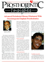 Insights Newsletter - Dental Implant Treatment for Advanced Periodontal Disease - 1996_02_9_1-1