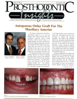 Insights Newsletter - Dental Autogenous Onlay Graft in Upper Arch -1998_11_11_2-1