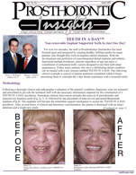 Insights Newsletter - Dental Implant Treatment Using Teeth In a Day<sup>®</sup> - 2001_04_14_1-1