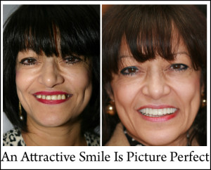 An Attractive Smile Is Picture Perfect