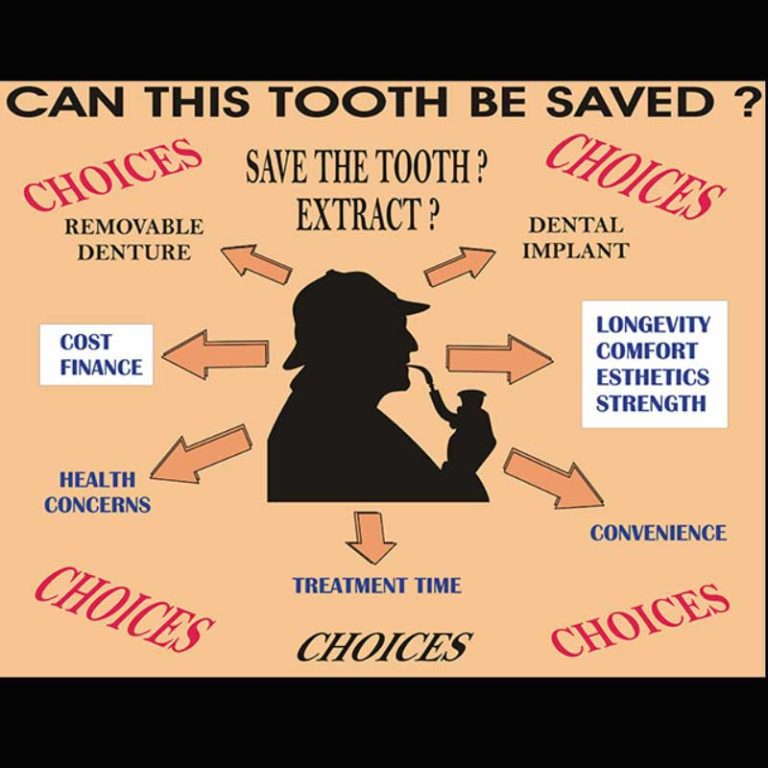 Can This Tooth Be Saved? Pi Dental Center, Fort Washington, PA