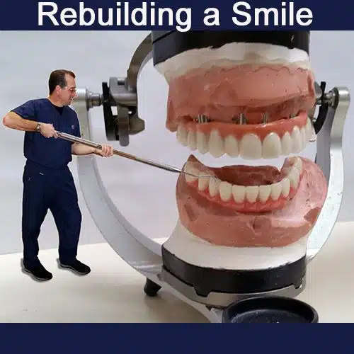 Rebuilding a Smile photo
