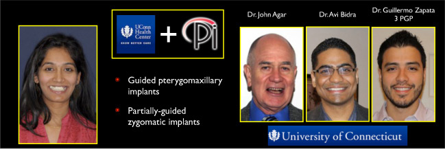 Pterygomaxillary Implants