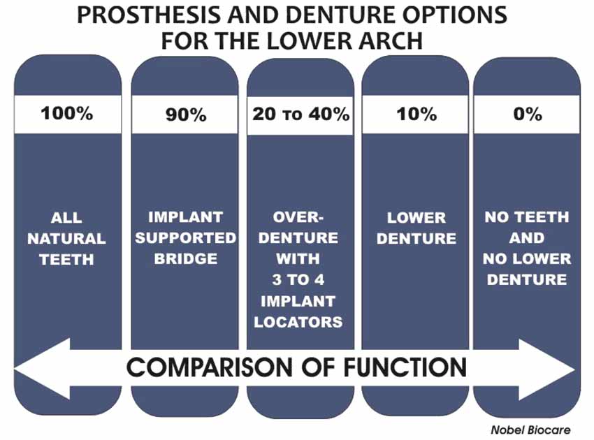 Prosthesis Function Comparison Chart
