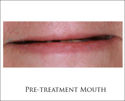 11040treatmentteammouth.jpg
