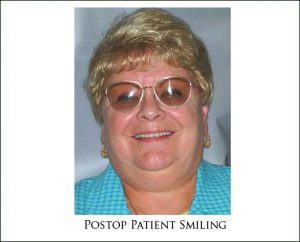 Replacement of Top Dentures with Dental Implants