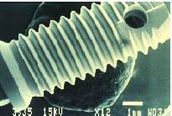 Analysis of 164 Titanium Oxide-Surface Implants