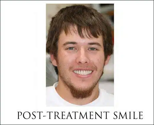 Pain Relief With Dental Implants