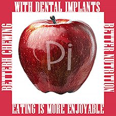 Top Ten Reasons to Choose Dental Implants