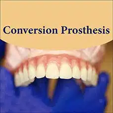 What’s a Conversion Prosthesis and Why Should You Care?