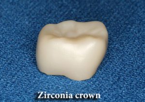 Zirconia crown