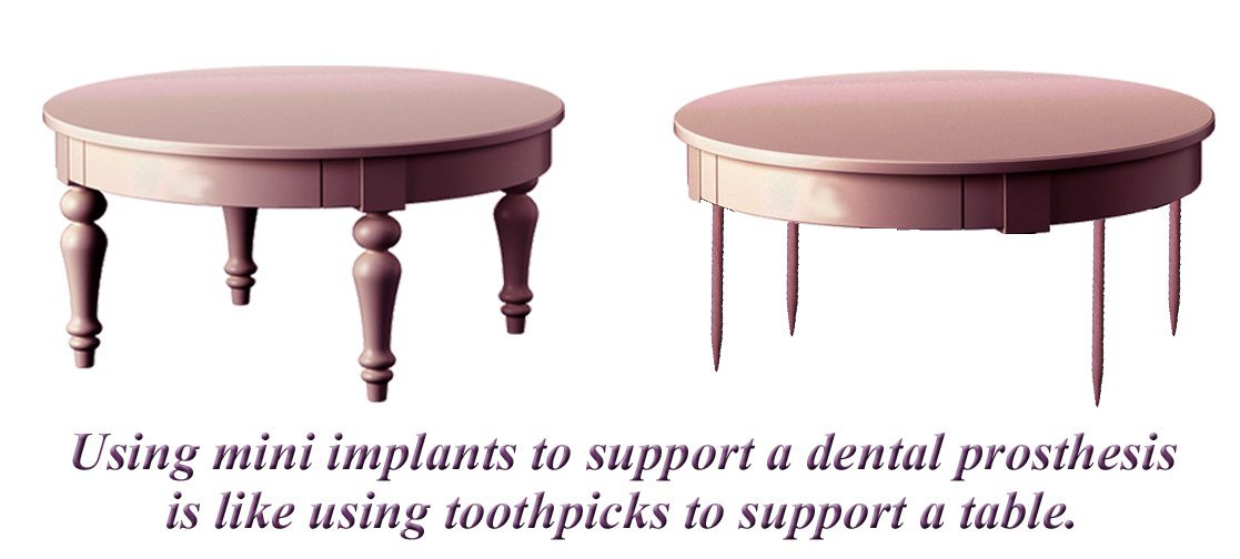 mini-implant-graphic-toothpick-table.jpg