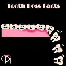 Tooth Loss Facts