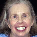 Patient Photo: A new smile using AvaDent digital technology.