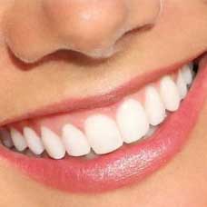 The Single Tooth Implant